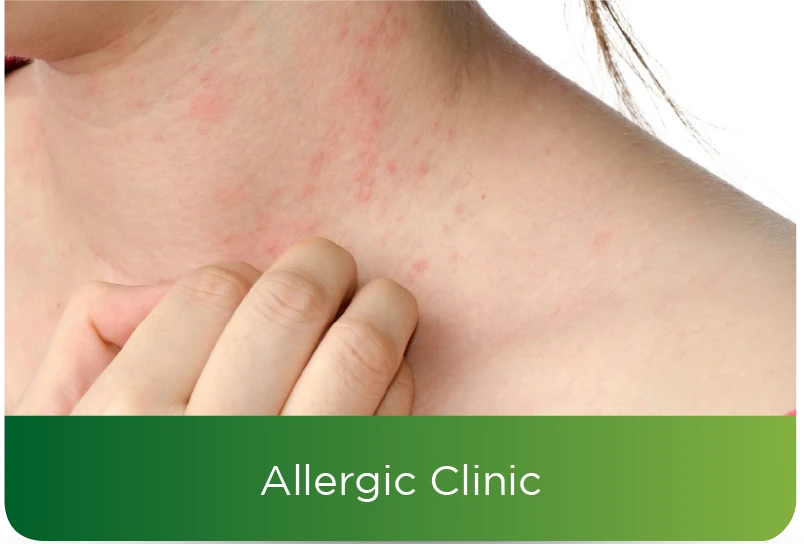 Allergic Clinic
